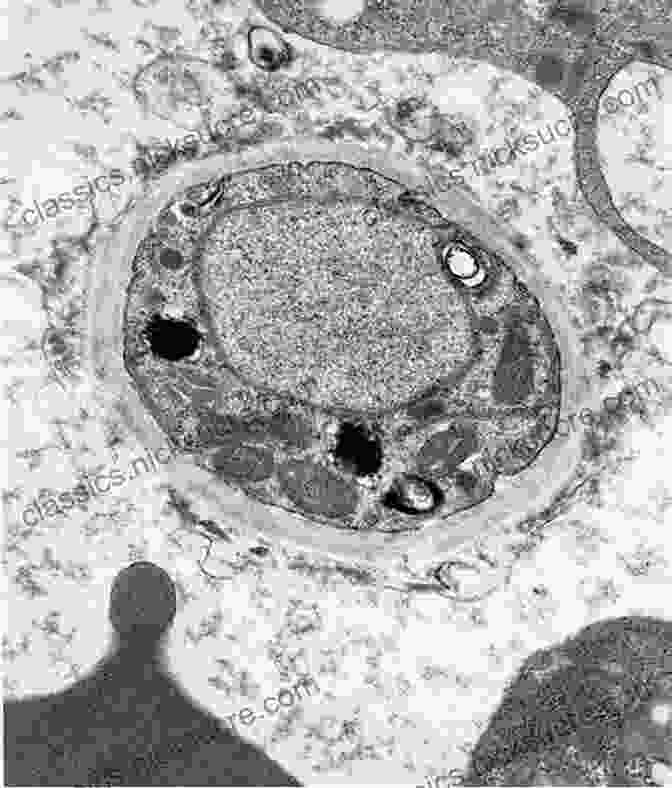 Transmission Electron Micrograph Of A Cannibalistic Virus Infecting A Yeast Cell Panic In Level 4: Cannibals Killer Viruses And Other Journeys To The Edge Of Science